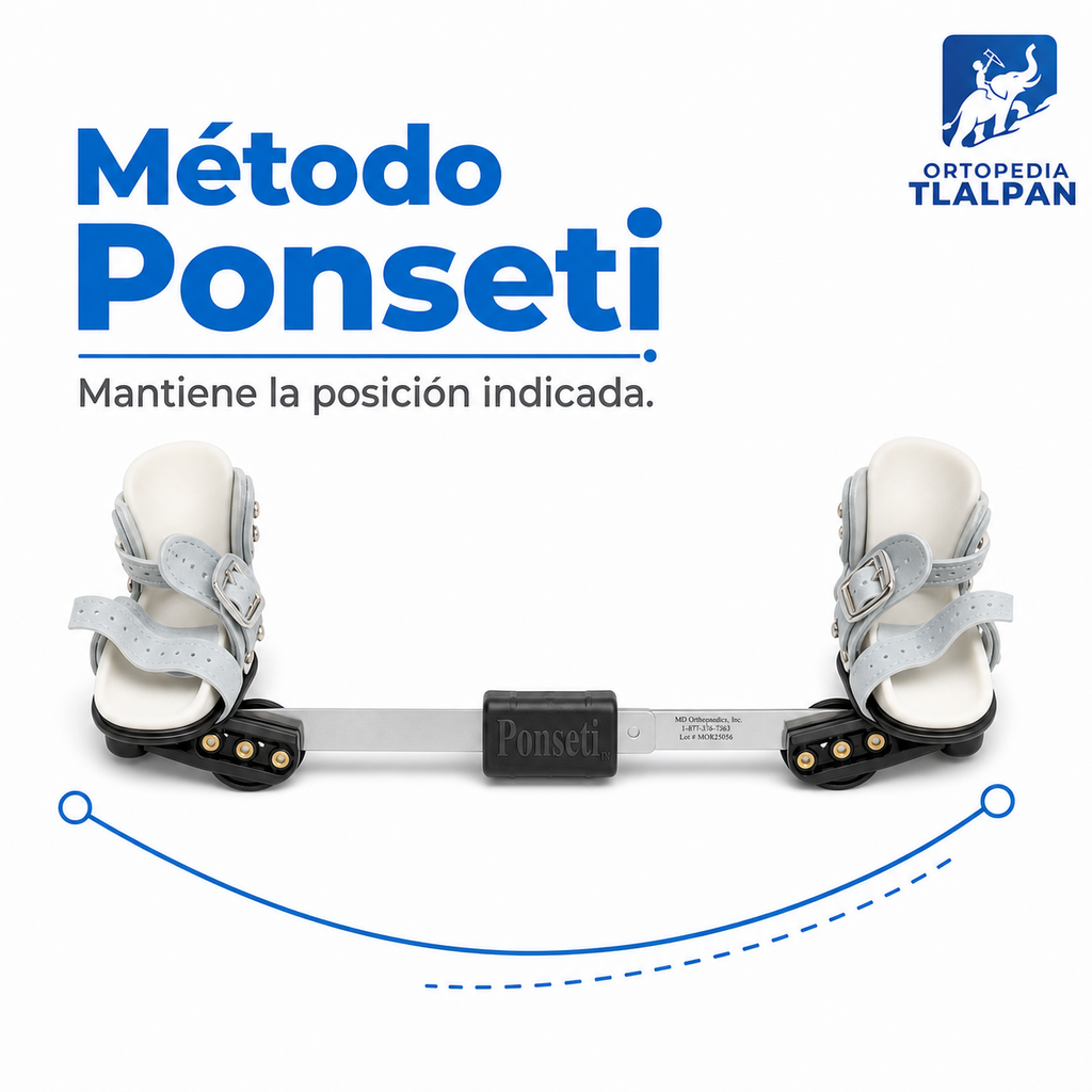 Barra Ponseti para Pie Equino Varo Infantil | Ortesis Ortopédica de Aluminio Ligero